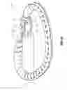Fig. 20 - Systems and methods for delivery of annuloplasty rings