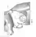 Fig. 22 - Systems and methods for delivery of annuloplasty rings