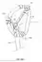 Fig. 25 - Systems and methods for delivery of annuloplasty rings