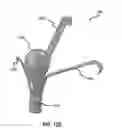 Fig. 27 - Systems and methods for delivery of annuloplasty rings