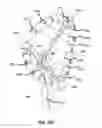 Fig. 28 - Systems and methods for delivery of annuloplasty rings