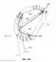 Fig. 30 - Systems and methods for delivery of annuloplasty rings