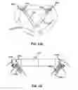Fig. 33 - Systems and methods for delivery of annuloplasty rings