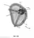 Fig. 41 - Systems and methods for delivery of annuloplasty rings