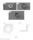 Fig. 04 - Self-adjusting tissue holder