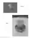 Fig. 08 - Self-adjusting tissue holder