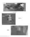 Fig. 09 - Self-adjusting tissue holder