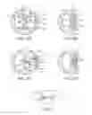 Fig. 03 - Steerable lesion excluding heart implants for congestive heart failure