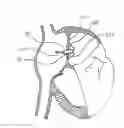 Fig. 01 - Methods, systems, and devices for resizable intra-atrial shunts