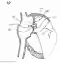Fig. 03 - Methods, systems, and devices for resizable intra-atrial shunts