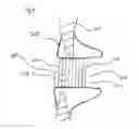 Fig. 07 - Methods, systems, and devices for resizable intra-atrial shunts