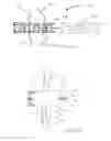 Fig. 11 - Methods, systems, and devices for resizable intra-atrial shunts