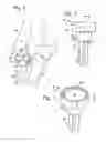Fig. 02 - Radial head prosthesis with floating articular member