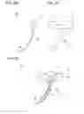 Fig. 05 - Implant assembly