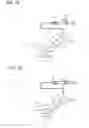Fig. 09 - Implant assembly
