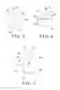 Fig. 03 - Expandable spinal interbody device