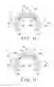Fig. 07 - Expandable spinal interbody device
