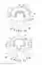 Fig. 08 - Expandable spinal interbody device