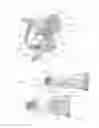 Fig. 02 - Expandable intervertebral implant