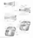 Fig. 12 - Expandable intervertebral implant