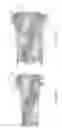 Fig. 16 - Expandable intervertebral implant