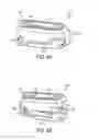 Fig. 08 - EXPANDABLE INTERVERTEBRAL CAGE ASSEMBLIES