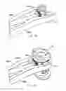 Fig. 13 - Expandable vertebral prosthesis