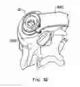 Fig. 17 - Expandable vertebral prosthesis