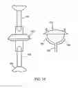 Fig. 19 - Expandable vertebral prosthesis
