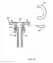 Fig. 20 - Expandable vertebral prosthesis