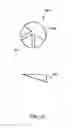 Fig. 26 - Expandable vertebral prosthesis