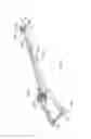 Fig. 12 - Expandable vertebral prosthesis