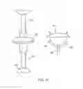 Fig. 19 - Expandable vertebral prosthesis