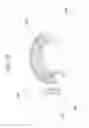 Fig. 32 - Expandable vertebral prosthesis