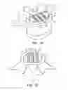 Fig. 13 - In-situ formed intervertebral fusion device and method