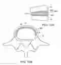 Fig. 18 - In-situ formed intervertebral fusion device and method