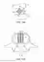 Fig. 20 - In-situ formed intervertebral fusion device and method