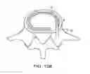 Fig. 22 - In-situ formed intervertebral fusion device and method