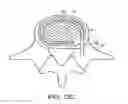 Fig. 23 - In-situ formed intervertebral fusion device and method