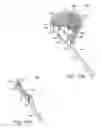 Fig. 29 - In-situ formed intervertebral fusion device and method