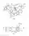 Fig. 05 - Implant inserter