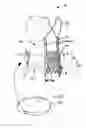 Fig. 01 - Prosthesis seals and methods for sealing an expandable prosthesis