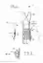 Fig. 02 - Prosthesis seals and methods for sealing an expandable prosthesis