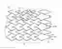 Fig. 01 - Stent