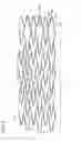 Fig. 03 - Stent