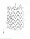 Fig. 04 - Stent