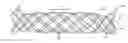Fig. 01 - Tracheobronchial implantable medical device and methods of use