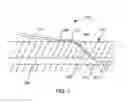 Fig. 08 - Anatomic needle system