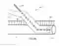 Fig. 11 - Anatomic needle system