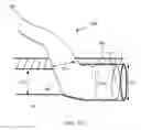 Fig. 15 - Anatomic needle system